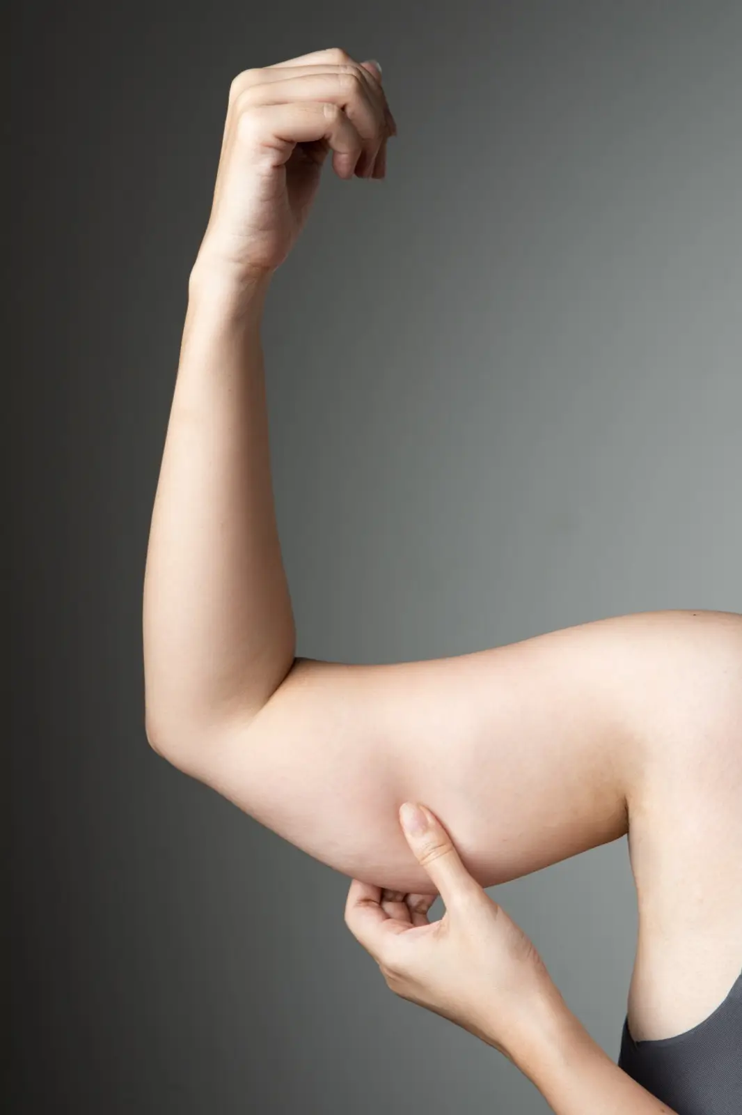 Arm lift (brachioplasty) in Turkey