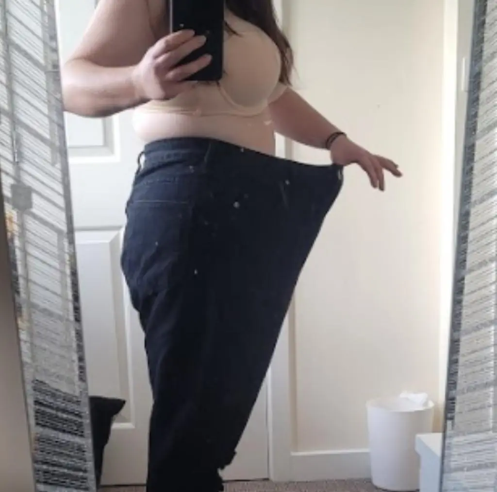 Patiente avant le traitement, photographiée en blouse clinique sur fond sombre
