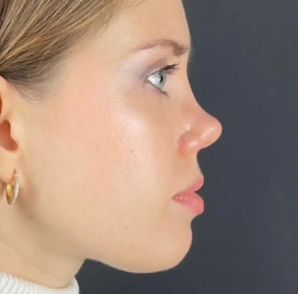 Patiente avant le traitement, photographiée en blouse clinique sur fond sombre