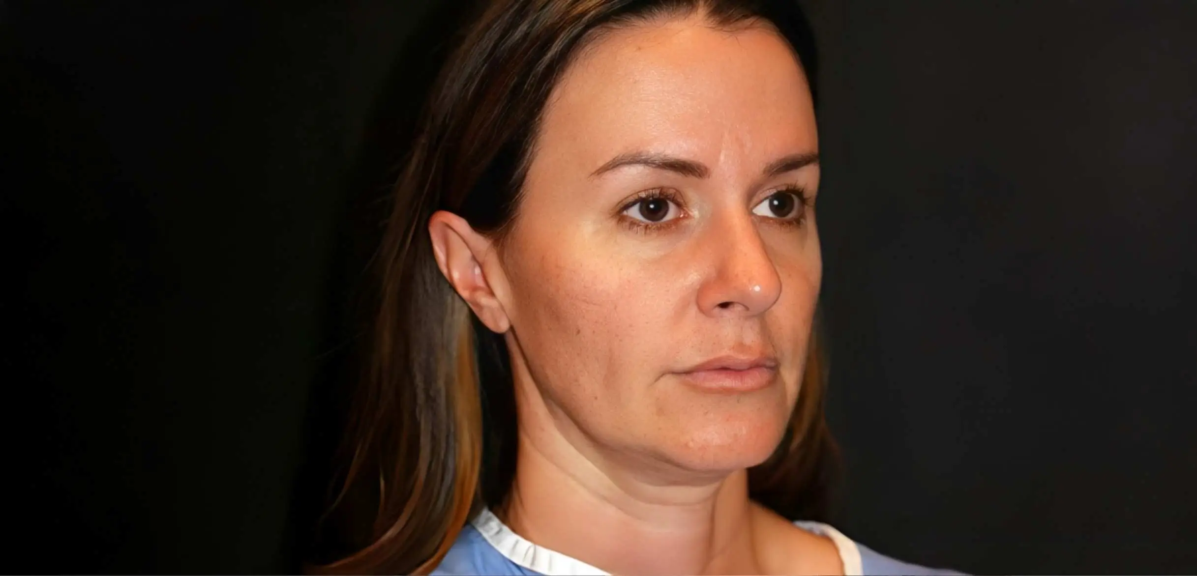 Patient photographed before treatment, wearing a clinical gown against a dark background