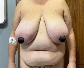 Mummy makeover, Before