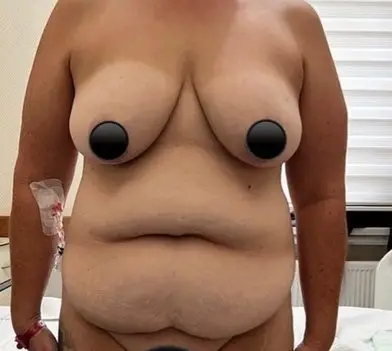 Mummy makeover, Before