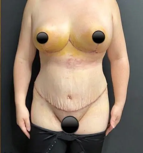 Mummy makeover, After