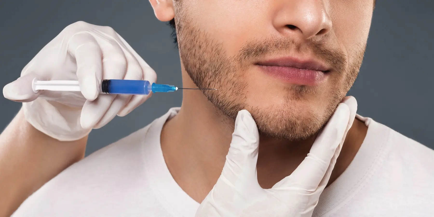 Trapianto di barba: consulto a Istanbul