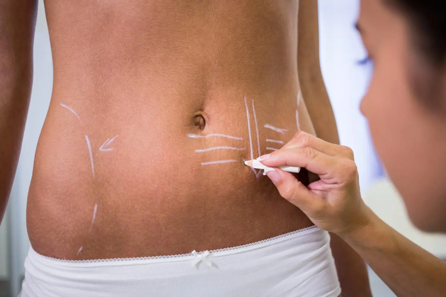 Body Contouring: Which Procedure Solves Which Problem