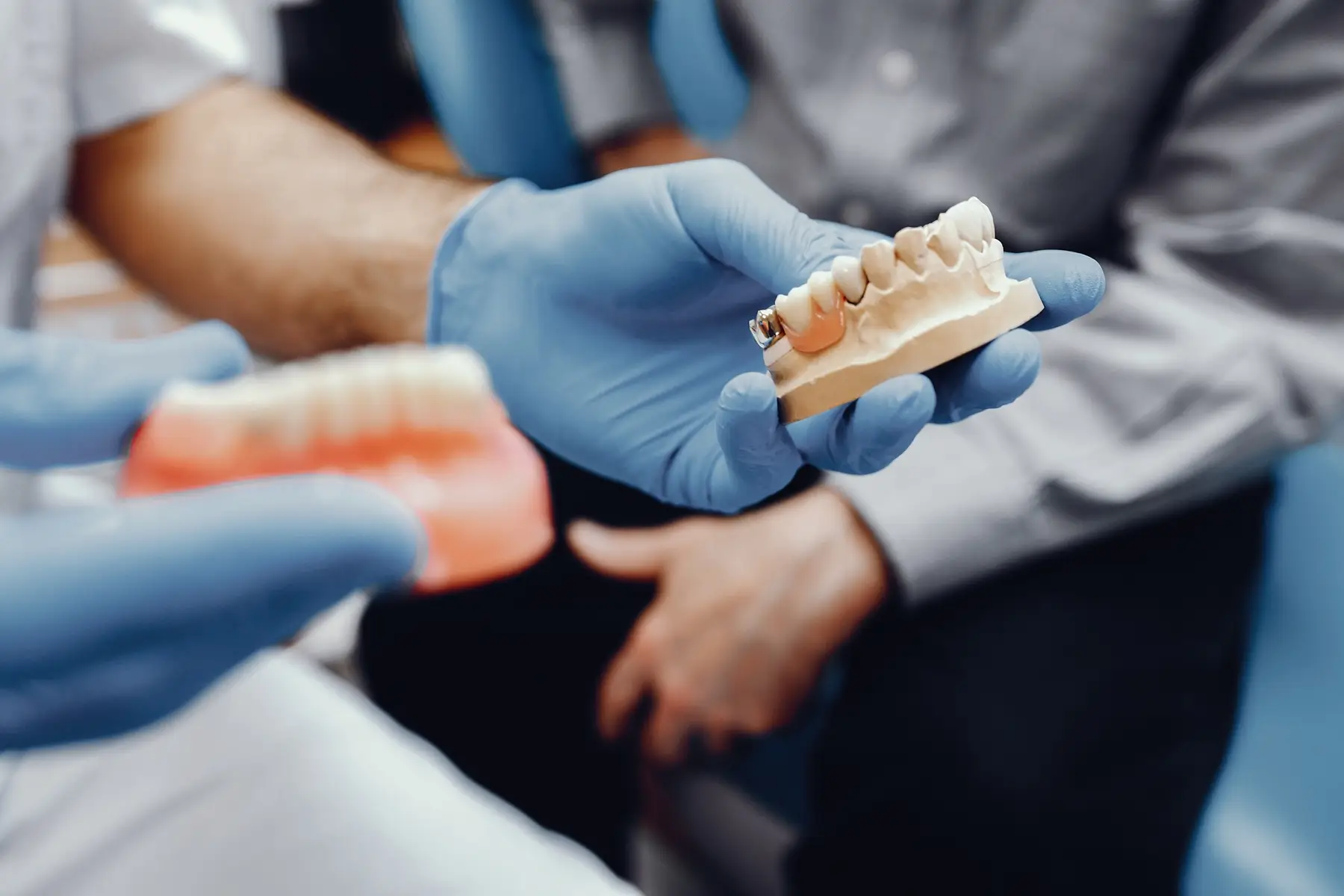 Dental crowns being checked against a shade guide during a consultation