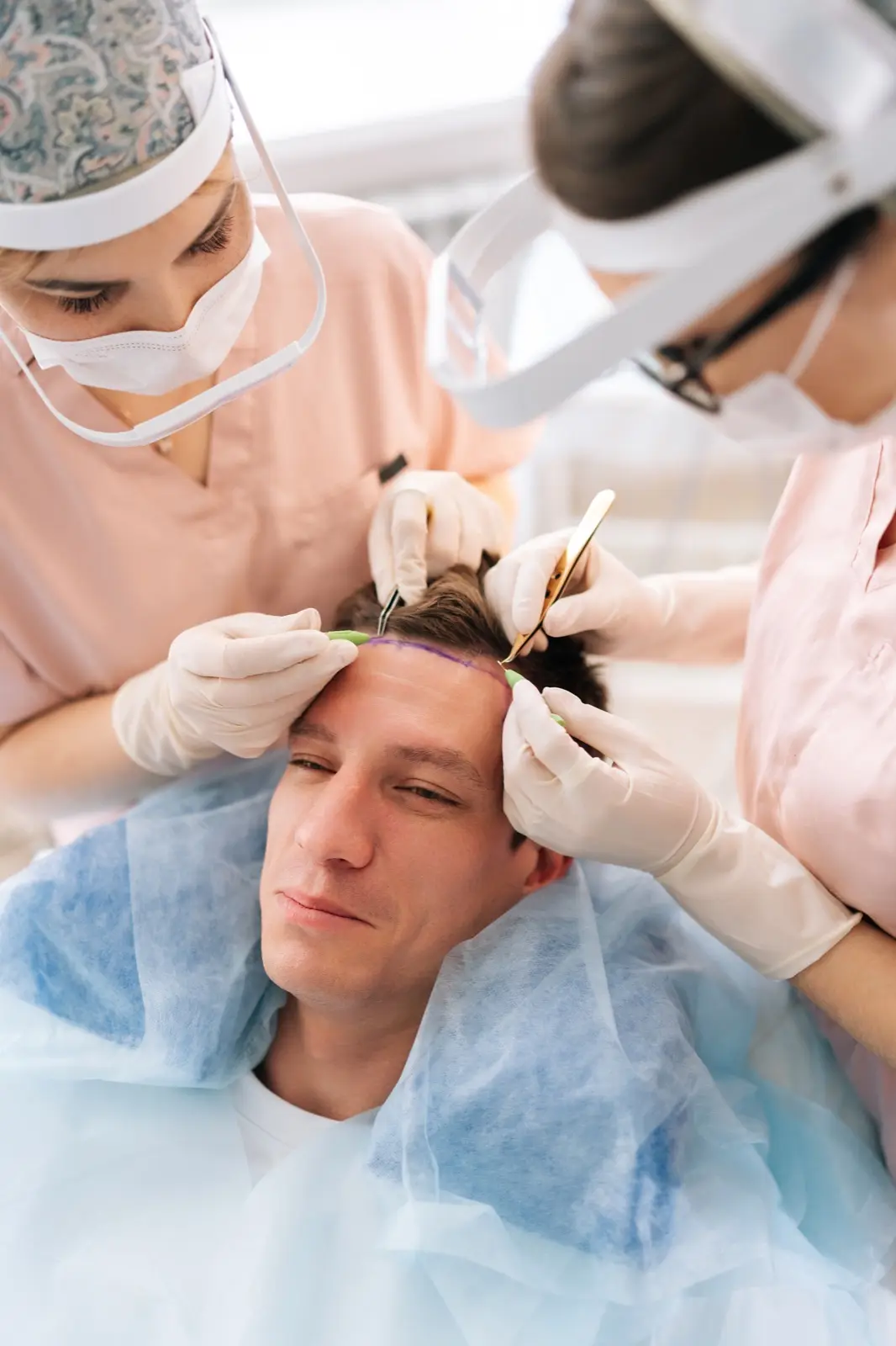 DHI hair transplant in Turkey