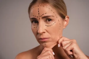 Female patient being prepared for cosmetic facial procedure in medical setting