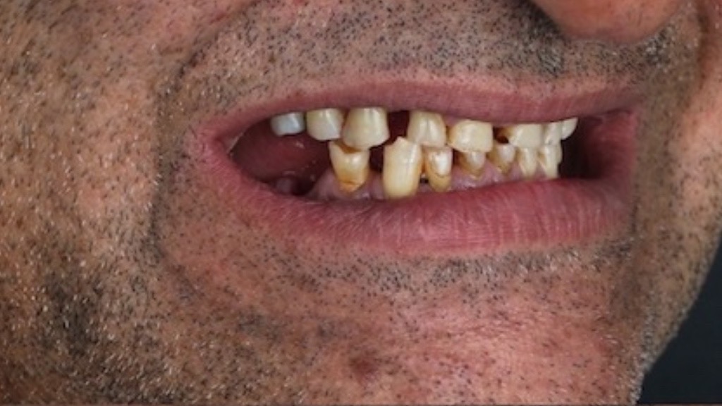 IMG 9063 Before & After