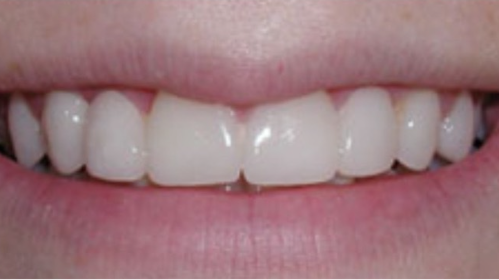 IMG 9066 Before & After