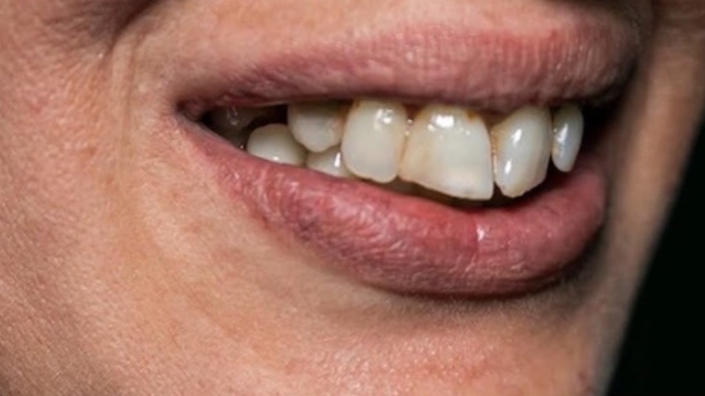 IMG 9069 Before & After