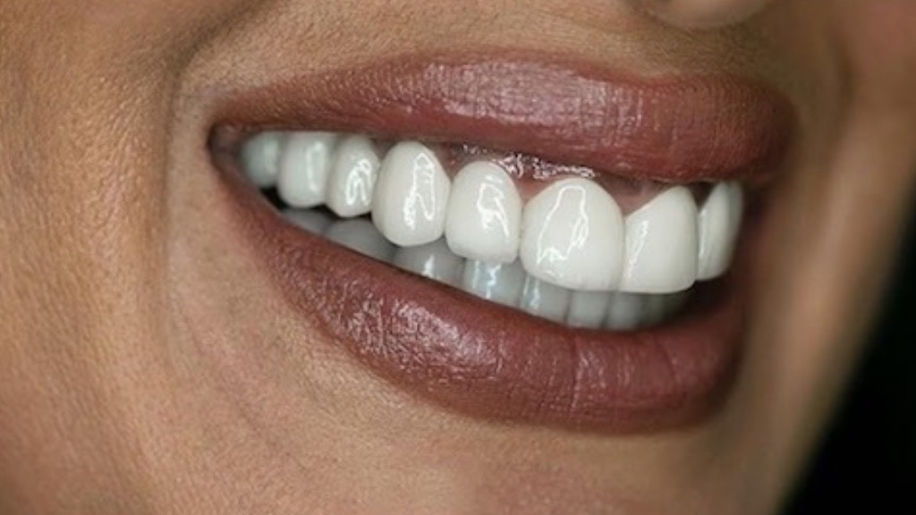 IMG 9070 Before & After