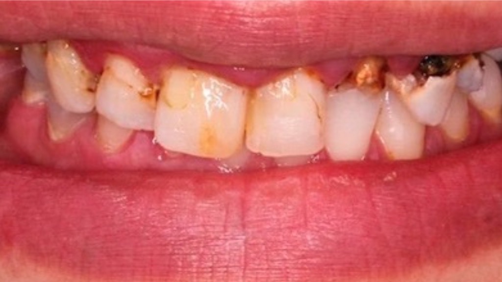 IMG 9075 Before & After