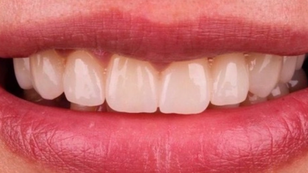 IMG 9076 Before & After