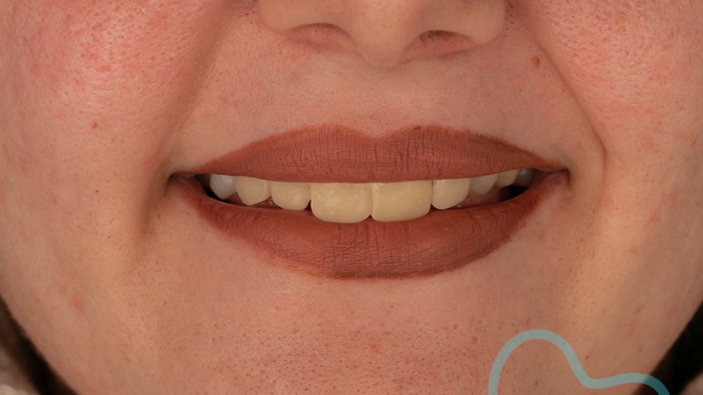 IMG 9096 Before & After