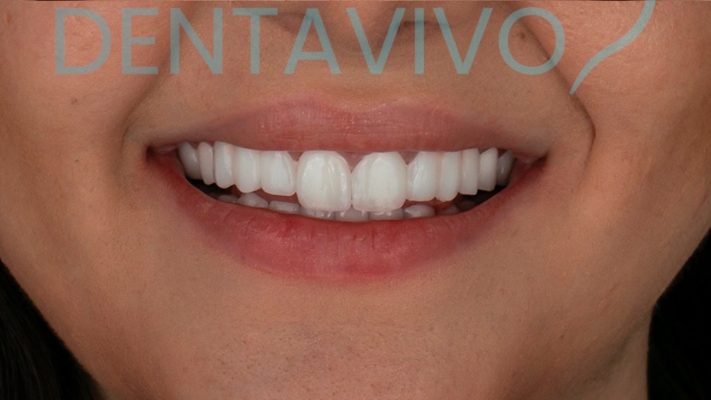 IMG 9097 Before & After