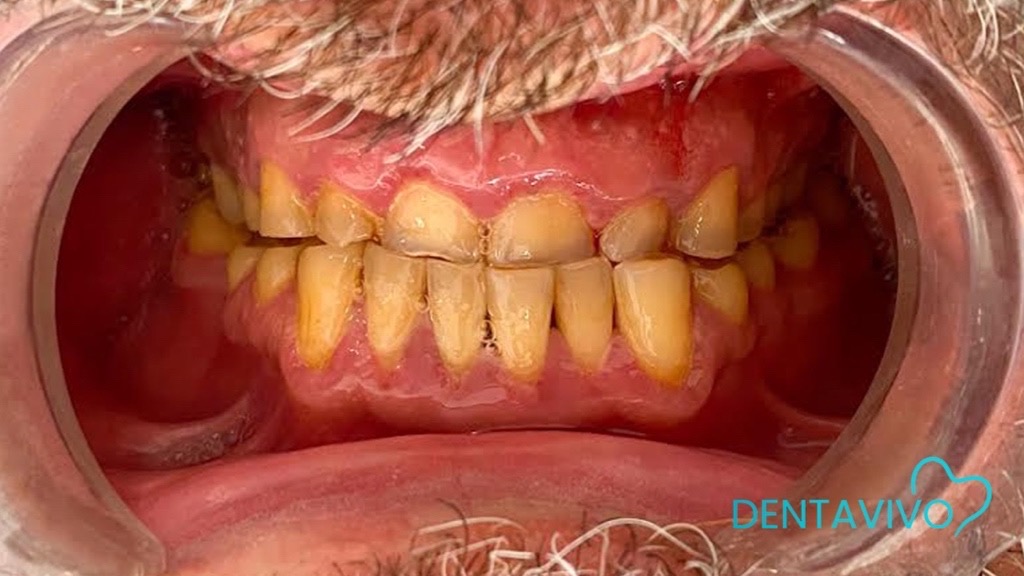 IMG 9104 Before & After