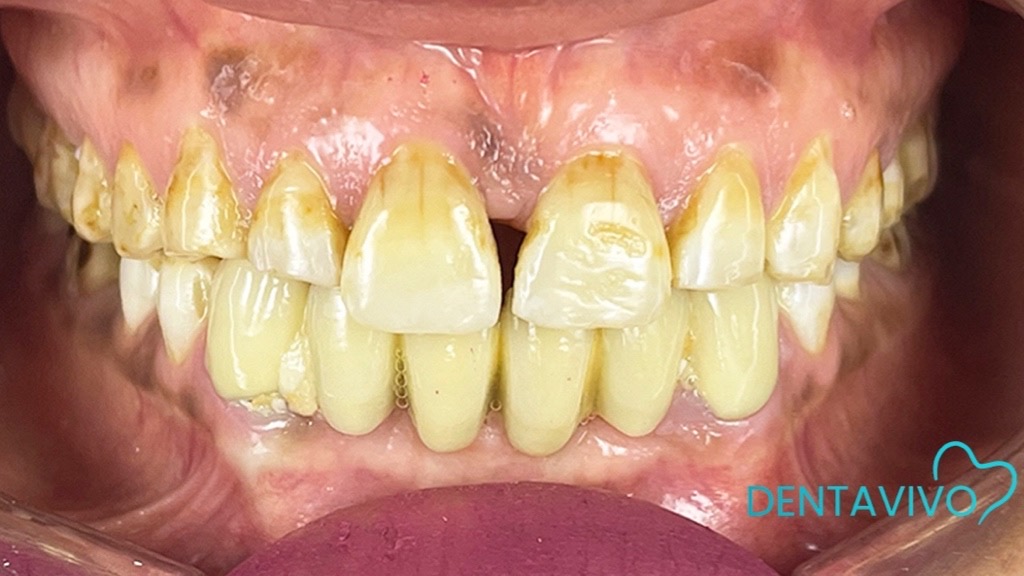 IMG 9106 Before & After