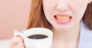 asian female coffee teeth yellow