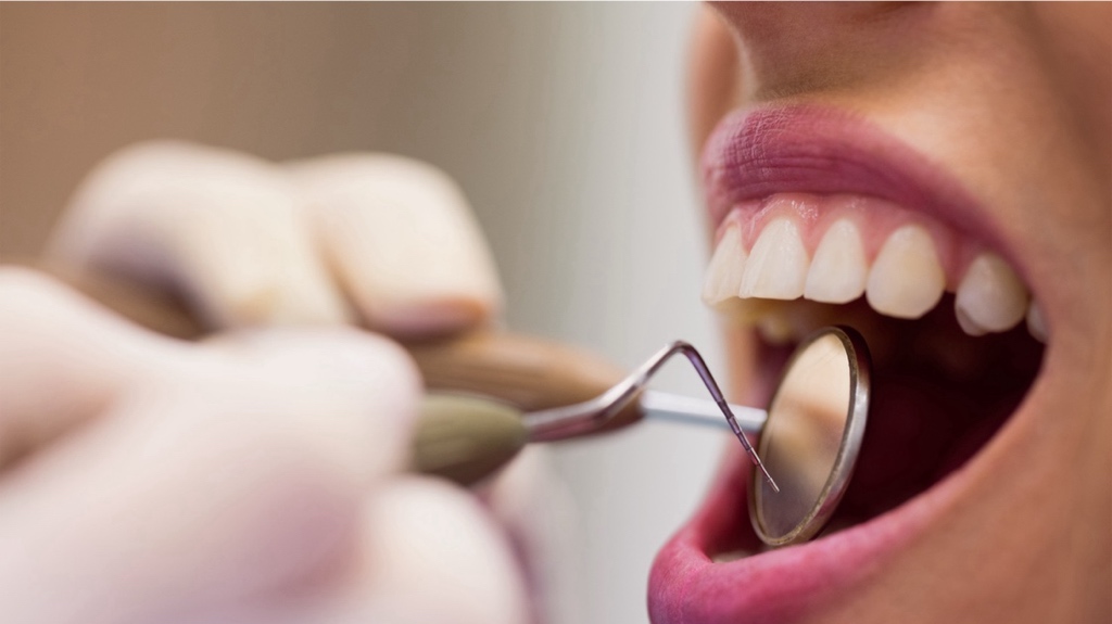 Veneers Before and After - The Hollywood Smile