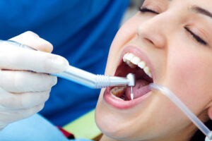Patient undergoing a dental cleaning with suction and scaler tools inside the mouth