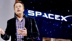 The Journey of Elon Musk Hair Transplant 4