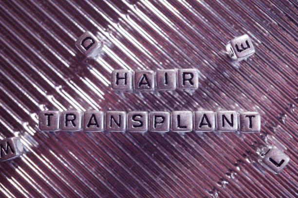 3 Reasons That Made 5000 Graft Hair Transplant Popular 7