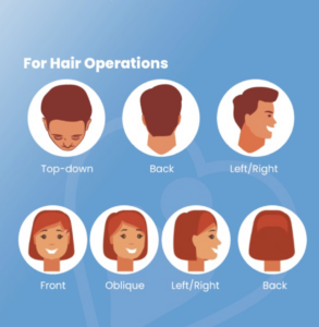 Hair Transplant Photo Guide 5
