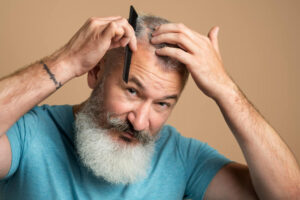 best age for hair transplant