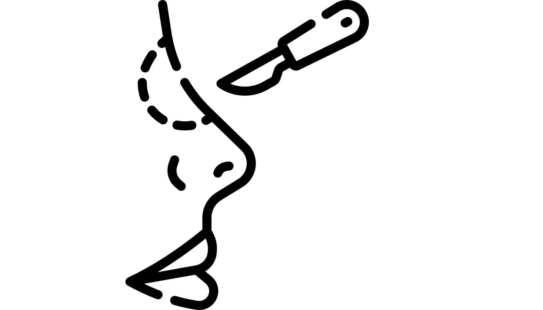 rhinoplasty istanbul