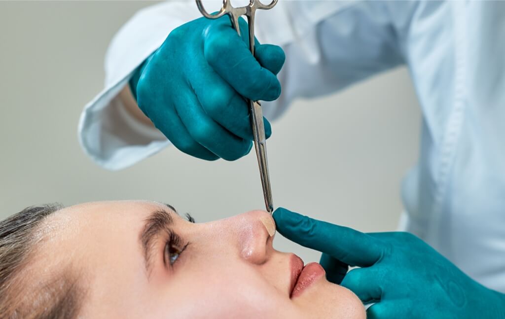 Deviated Septum, Functional Rhinoplasty