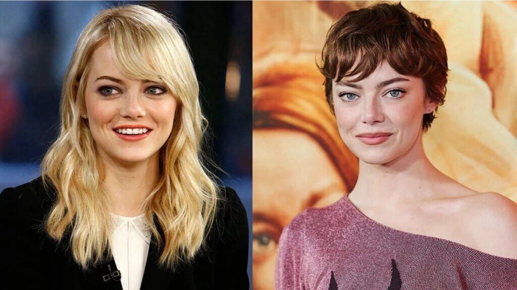 Emma Stone Plastic Surgery
