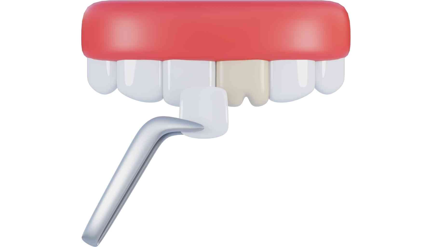 Rhinoplasty and veneers same day